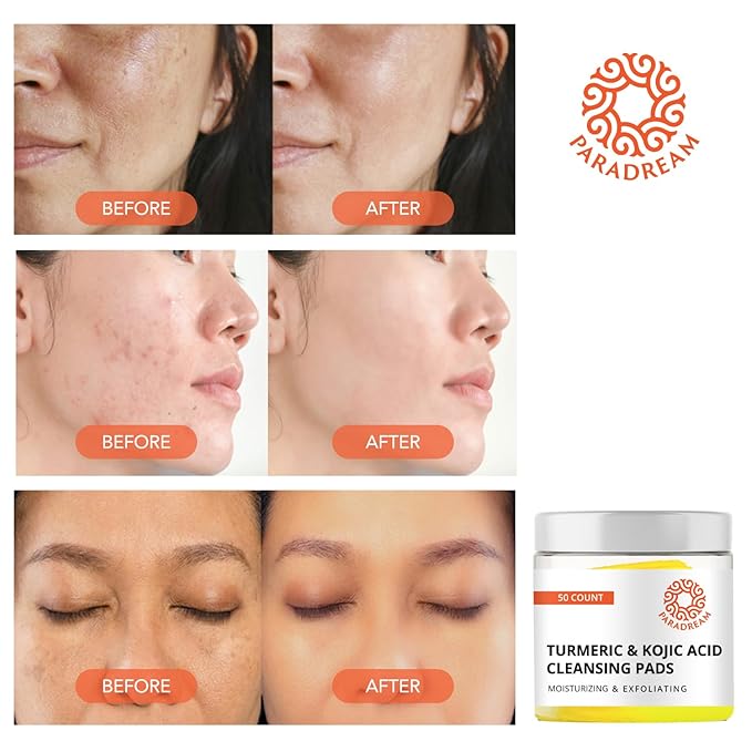 Turmeric Kojic Cleansing Pads: Face Exfoliating Pads for Acne Scars Skin Fades Skin Firming - Cleaning Pad with Turmeric and Kojic - Deep Clean Pores 50PCS