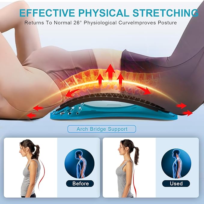 Back Stretcher for Lower Back Pain Relief, 4 Level Adjustable Arch Lumbar Back Cracker Board, Back Cracking Device, Back Massager for Scoliosis, Spine Decompression Support - Dark Blue