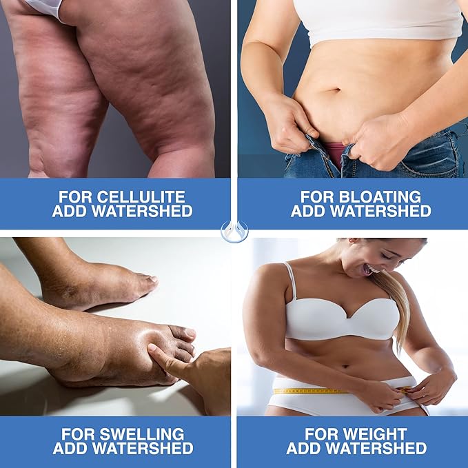 Water Pills Diuretic Water Retention, Liver Detox, Kidney Cleanse, Weight, Swelling, Edema, Bloating Relief, Fluid Balance Watershed Max Strength (1)